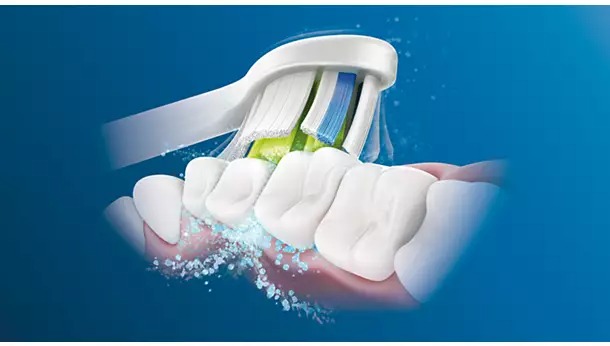 Công nghệ sóng âm độc quyền Philips Sonicare