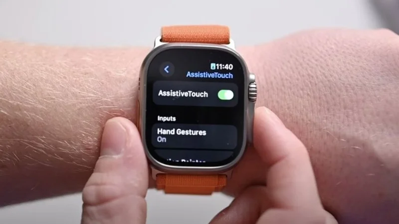 Điều kiện thiết bị hỗ trợ kích hoạt AssistiveTouch