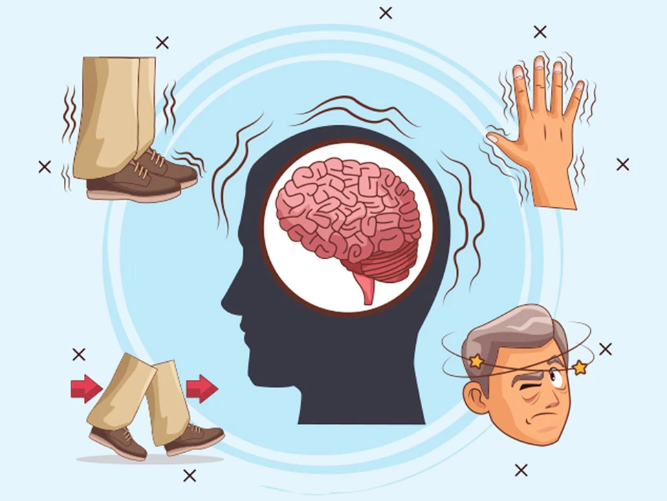 Siêu công nghệ phát hiện bệnh Parkinson tiềm ẩn