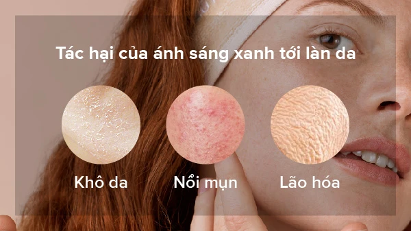 Ánh sáng xanh có hại cho da như thế nào?
