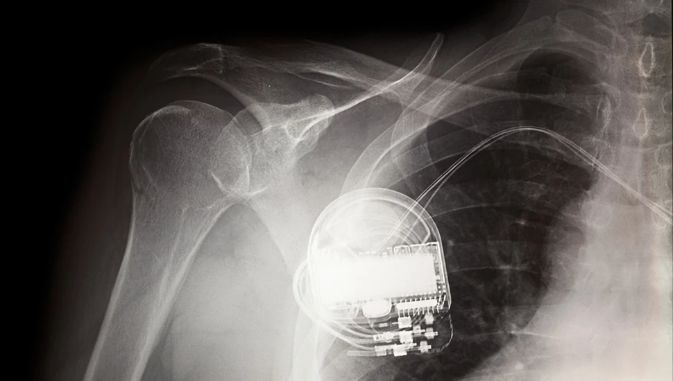 Apple đưa cảnh báo giữ điện thoại cách ngực tối thiểu 15cm