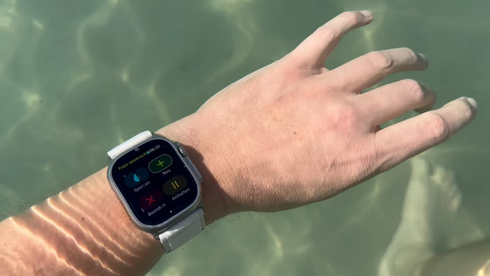 Điều khiển Assistive Touch trên Apple Watch