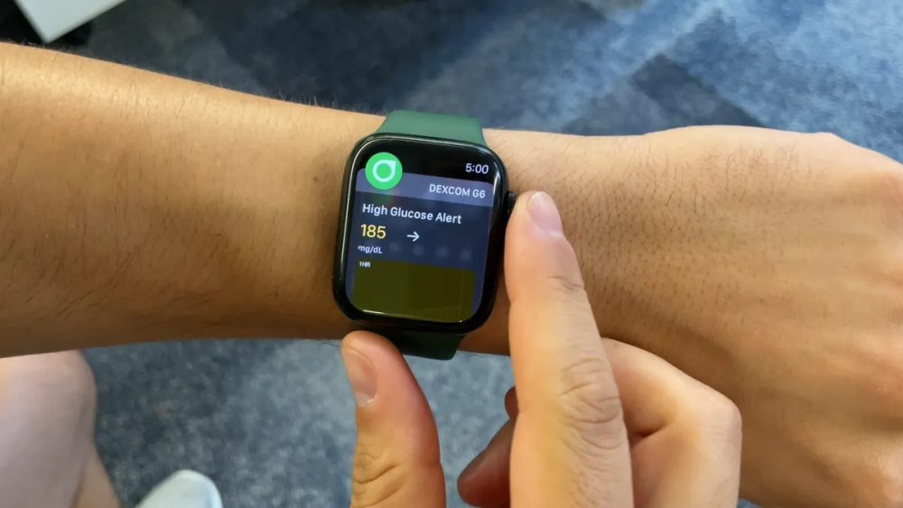 Với những đặc điểm này, đây là mẫu Apple Watch trong mơ mà mọi người luôn ao ước