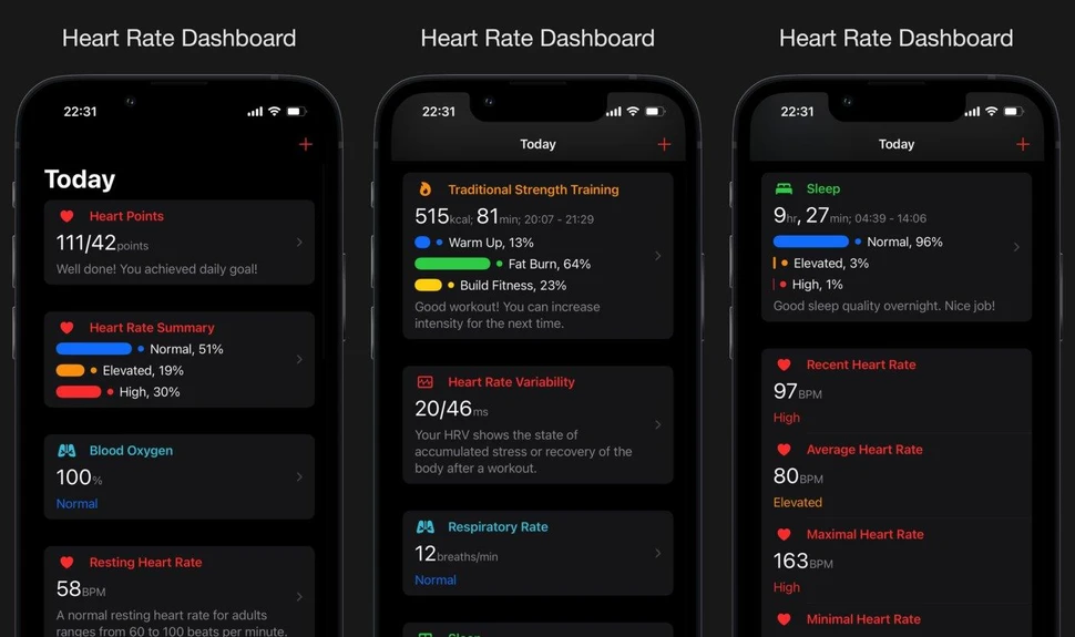 iPhone báo chỉ số căng thẳng từ dữ liệu Apple Watch