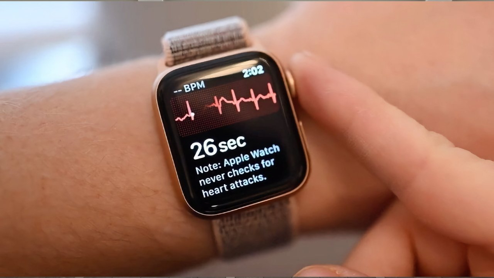 Tính năng ECG trên Apple Watch